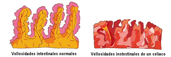 vellosidades-intestinales